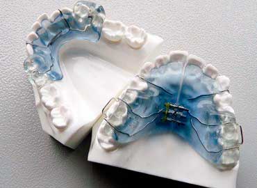expansores dentales